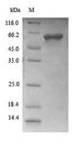 ACP 9, SAP9 Protein - (Tris-Glycine gel) Discontinuous SDS-PAGE (reduced) with 5% enrichment gel and 15% separation gel.