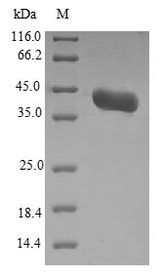 ALS3 Protein - (Tris-Glycine gel) Discontinuous SDS-PAGE (reduced) with 5% enrichment gel and 15% separation gel.