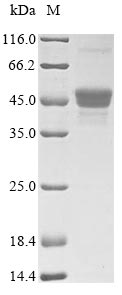 PRA1 Protein - (Tris-Glycine gel) Discontinuous SDS-PAGE (reduced) with 5% enrichment gel and 15% separation gel.