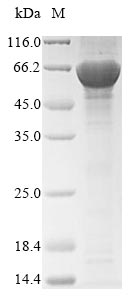 Acetyl-CoA Carboxylase / ACC Protein - (Tris-Glycine gel) Discontinuous SDS-PAGE (reduced) with 5% enrichment gel and 15% separation gel.