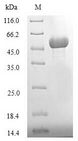ATG1 Protein - (Tris-Glycine gel) Discontinuous SDS-PAGE (reduced) with 5% enrichment gel and 15% separation gel.