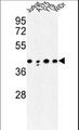CANT1 Antibody - Western blot of CANT1 Antibody in Jurkat, A375, Y79, WiDr cell line lysates (35 ug/lane). CANT1 (arrow) was detected using the purified antibody.