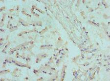 CANT1 Antibody - Immunohistochemistry of paraffin-embedded human prostate using antibody at 1:100 dilution.