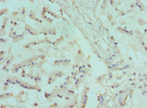 CANT1 Antibody - Immunohistochemistry of paraffin-embedded human prostate tissue using CANT1 Antibody at dilution of 1:100