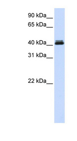 CANT1 Antibody - CANT1 antibody Western blot of Transfected 293T cell lysate. This image was taken for the unconjugated form of this product. Other forms have not been tested.