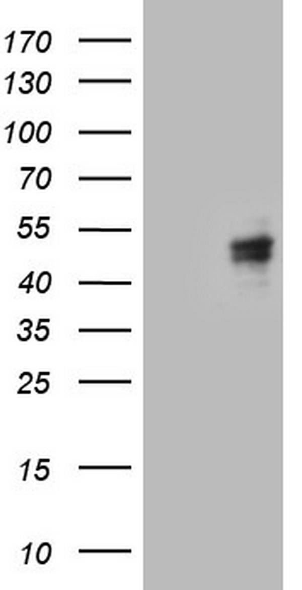 CANT1 Antibody - HEK293T cells were transfected with the pCMV6-ENTRY control. (Left lane) or pCMV6-ENTRY CANT1. (Right lane) cDNA for 48 hrs and lysed. Equivalent amounts of cell lysates. (5 ug per lane) were separated by SDS-PAGE and immunoblotted with anti-CANT1.