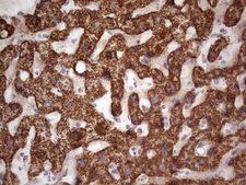 CANT1 Antibody - Immunohistochemical staining of paraffin-embedded Human liver tissue within the normal limits using anti-CANT1 mouse monoclonal antibody. (Heat-induced epitope retrieval by 1 mM EDTA in 10mM Tris, pH8.5, 120C for 3min,