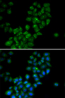 CANT1 Antibody - Immunofluorescence analysis of HeLa cells.