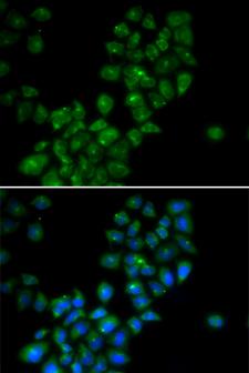 CANT1 Antibody - Immunofluorescence analysis of HeLa cells.