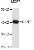 CANT1 Antibody - Western blot analysis of extracts of MCF7 cells, using CANT1 antibody at 1:1000 dilution. The secondary antibody used was an HRP Goat Anti-Rabbit IgG (H+L) at 1:10000 dilution. Lysates were loaded 25ug per lane and 3% nonfat dry milk in TBST was used for blocking. An ECL Kit was used for detection and the exposure time was 60s.