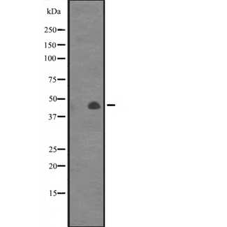 CANT1 Antibody - Western blot analysis of CANT1 expression in Jurkat cells line lysates. The lane on the left is treated with the antigen-specific peptide.