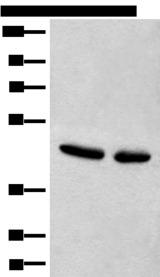 CANT1 Antibody - Western blot analysis of Hela and A375 cell lysates  using CANT1 Polyclonal Antibody at dilution of 1:500