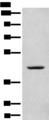 CANT1 Antibody - Western blot analysis of A375 cell lysate  using CANT1 Polyclonal Antibody at dilution of 1:500