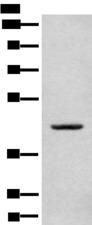 CANT1 Antibody - Western blot analysis of A375 cell lysate  using CANT1 Polyclonal Antibody at dilution of 1:500