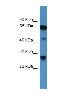 CANX / Calnexin Antibody - CANX / Calnexin antibody western blot of Human fetal liver lysate. Antibody concentration 1 ug/ml.  This image was taken for the unconjugated form of this product. Other forms have not been tested.