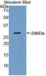 CANX / Calnexin Antibody - Western blot of recombinant CANX / Calnexin.  This image was taken for the unconjugated form of this product. Other forms have not been tested.