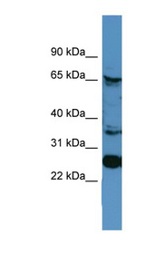 CANX / Calnexin Antibody - CANX / Calnexin antibody Western blot of A549 cell lysate.  This image was taken for the unconjugated form of this product. Other forms have not been tested.