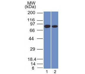 CANX / Calnexin Antibody - Western blot testing of human 1) PANC-1 and 2) MCF7 cell lysate with Calnexin antibody (clone CANX/1543). Predicted molecular weight ~68 kDa but routinely observed at ~90 kDa.