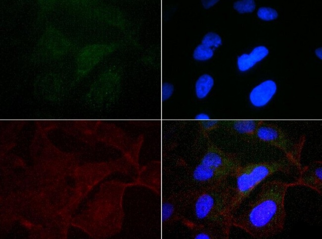 CANX / Calnexin Antibody - Immunocytochemistry/Immunofluorescence: Calnexin Antibody - Antibody was tested at 1:50 in HeLa cells with FITC (green). Nuclei and actin were counterstained with DAPI (blue) and Phalloidin (red).  This image was taken for the unconjugated form of this product. Other forms have not been tested.