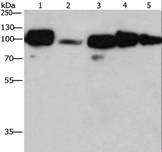 CANX / Calnexin Antibody - Western blot analysis of HeLa cell and mouse liver tissue, 231 cell and human placenta tissue, human carcinoma of sigmoid tissue, using CANX Polyclonal Antibody at dilution of 1:420.