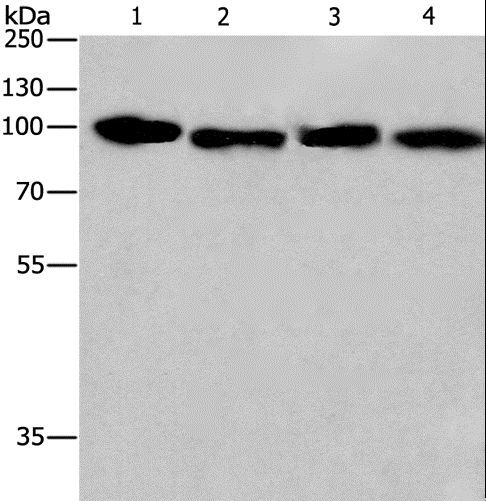 CANX / Calnexin Antibody - Western blot analysis of HeLa and 231 cell, human placenta and carcinoma of sigmoid tissue, using CANX Polyclonal Antibody at dilution of 1:615.