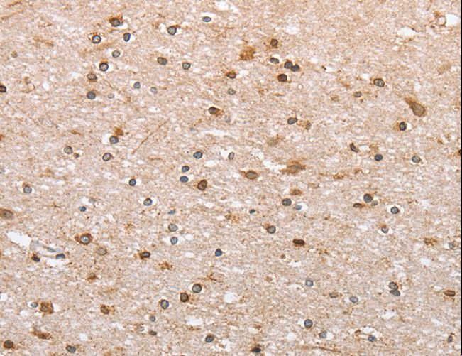 CANX / Calnexin Antibody - Immunohistochemistry of paraffin-embedded Human brain using CANX Polyclonal Antibody at dilution of 1:50.