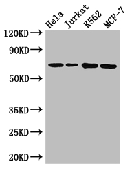 CANX / Calnexin Antibody - Positive WB detected in:Hela whole cell lysate,Jurkat whole cell lysate,K562 whole cell lysate,MCF-7 whole cell lysate;All lanes: CANX antibody at 2.7ug/ml;Secondary;Goat polyclonal to rabbit IgG at 1/50000 dilution;Predicted band size: 68,72,56 kDa;Observed band size: 68 kDa;