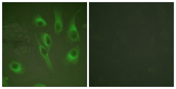 CANX / Calnexin Antibody - Immunofluorescence analysis of HeLa cells, using Calnexin (Phospho-Ser583) Antibody. The picture on the right is blocked with the phospho peptide.
