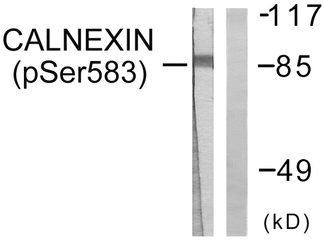 CANX / Calnexin Antibody - Western blot analysis of lysates from HeLa cells treated with EGF 200ng/ml 30', using Calnexin (Phospho-Ser583) Antibody. The lane on the right is blocked with the phospho peptide.