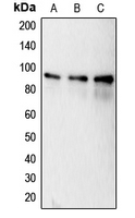 CANX / Calnexin Antibody - Western blot analysis of Calnexin (pS583) expression in MCF7 (A); HeLa (B); MDAMB231 (C) whole cell lysates.