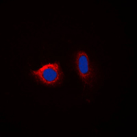 CANX / Calnexin Antibody - Immunofluorescent analysis of Calnexin (pS583) staining in HeLa cells. Formalin-fixed cells were permeabilized with 0.1% Triton X-100 in TBS for 5-10 minutes and blocked with 3% BSA-PBS for 30 minutes at room temperature. Cells were probed with the primary antibody in 3% BSA-PBS and incubated overnight at 4 C in a humidified chamber. Cells were washed with PBST and incubated with a DyLight 594-conjugated secondary antibody (red) in PBS at room temperature in the dark. DAPI was used to stain the cell nuclei (blue).