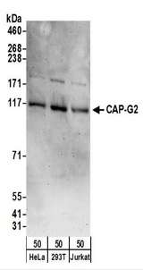 CAP-G2 / MTB Antibody - Detection of Human CAP-G2 by Western Blot. Samples: Whole cell lysate (50 ug) from HeLa, 293T, and Jurkat cells. Antibodies: Affinity purified rabbit anti-CAP-G2 antibody used for WB at 0.1 ug/ml. Detection: Chemiluminescence with an exposure time of 3 minutes.