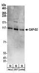 CAP-G2 / MTB Antibody - Detection of Human CAP-G2 by Western Blot. Samples: Whole cell lysate (50 ug) from HeLa, 293T, and Jurkat cells. Antibodies: Affinity purified rabbit anti-CAP-G2 antibody used for WB at 0.1 ug/ml. Detection: Chemiluminescence with an exposure time of 3 minutes.