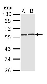 CAP1 Antibody - Sample (30 ug of whole cell lysate). A: Hep G2 , B: Raji. 10% SDS PAGE. CAP1 antibody diluted at 1:1000.