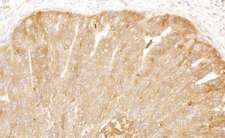 CAP1 Antibody - Detection of human CAP1 by immunohistochemistry. Sample: FFPE section of human ovarian carcinoma. Antibody: Affinity purified rabbit anti- CAP1 used at a dilution of 1:1,000 (1µg/ml). Detection: DAB
