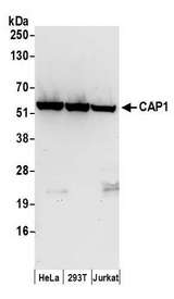 CAP1 Antibody - Detection of human CAP1 by western blot. Samples: Whole cell lysate (50 µg) from HeLa, HEK293T, and Jurkat cells prepared using NETN lysis buffer. Antibodies: Affinity purified rabbit anti-CAP1 antibody used for WB at 0.1 µg/ml. Detection: Chemiluminescence with an exposure time of 30 seconds.