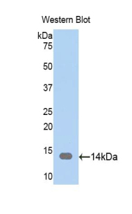 CAP1 Antibody - Western blot of recombinant CAP1.  This image was taken for the unconjugated form of this product. Other forms have not been tested.