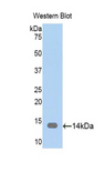 CAP1 Antibody - Western blot of recombinant CAP1.  This image was taken for the unconjugated form of this product. Other forms have not been tested.