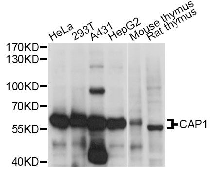 CAP1 Antibody - Western blot analysis of extracts of various cell lines, using CAP1 antibody at 1:1000 dilution. The secondary antibody used was an HRP Goat Anti-Rabbit IgG (H+L) at 1:10000 dilution. Lysates were loaded 25ug per lane and 3% nonfat dry milk in TBST was used for blocking. An ECL Kit was used for detection and the exposure time was 1s.