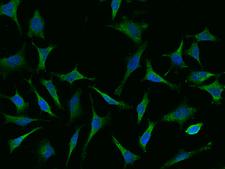CAP1 Antibody - Immunofluorescence staining of CAP1 in Hela cells. Cells were fixed with 4% PFA, blocked with 10% serum, and incubated with rabbit anti-human CAP1 polyclonal antibody (dilution ratio 1:1000) at 4°C overnight. Then cells were stained with the Alexa Fluor 488-conjugated Goat Anti-rabbit IgG secondary antibody (green) and counterstained with DAPI (blue). Positive staining was localized to Cytoplasm.