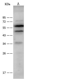 CAP1 Antibody - Anti-CAP1 rabbit polyclonal antibody at 1:500 dilution. Lane A: HeLa Whole Cell Lysate. Lysates/proteins at 30 ug per lane. Secondary: Goat Anti-Rabbit IgG (H+L)/HRP at 1/10000 dilution. Developed using the ECL technique. Performed under reducing conditions. Predicted band size: 52 kDa.