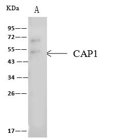CAP1 Antibody - CAP1 was immunoprecipitated using: Lane A: 0.5 mg 293T Whole Cell Lysate. 4 uL anti-CAP1 rabbit polyclonal antibody and 60 ug of Immunomagnetic beads Protein A/G. Primary antibody: Anti-CAP1 rabbit polyclonal antibody, at 1:100 dilution. Secondary antibody: Clean-Blot IP Detection Reagent (HRP) at 1:1000 dilution. Developed using the ECL technique. Performed under reducing conditions. Predicted band size: 52 kDa. Observed band size: 50 kDa.