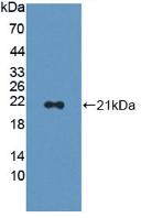 CAP2 Antibody - Western Blot; Sample: Recombinant CAP2, Human.
