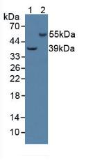 CAP2 Antibody - Western Blot; Sample: Lane1: Human HepG2 Cells; Lane2: Porcine Brain Tissue.