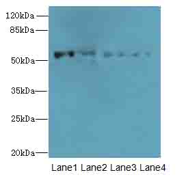 CAP2 Antibody - Western blot. All lanes: CAP2 antibody at 4 ug/ml. Lane 1: HepG-2 whole cell lysate. Lane 2: Mouse muscle tissue. Lane 3: Mouse gonadal tissue. Lane 4: HeLa whole cell lysate. Secondary Goat polyclonal to Rabbit IgG at 1:10000 dilution. Predicted band size: 53 kDa. Observed band size: 53 kDa.