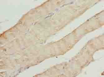 CAP2 Antibody - Immunohistochemistry of paraffin-embedded human skeletal muscle tissue using antibody at dilution of 1:100.