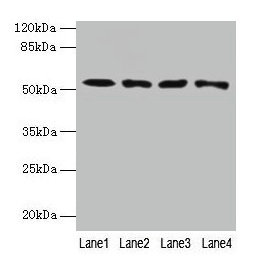 CAP2 Antibody - Western blot All lanes: CAP2 antibody at 4µg/ml Lane 1: HepG2 whole cell lysate Lane 2: Mouse muscle tissue Lane 3: Mouse gonadal tissue Lane 4: Hela whole cell lysate Secondary Goat polyclonal to rabbit IgG at 1/10000 dilution Predicted band size: 53, 46, 25 kDa Observed band size: 53 kDa