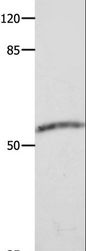 CAP2 Antibody - Western blot analysis of Human fetal muscle tissue, using CAP2 Polyclonal Antibody at dilution of 1:600.
