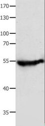 CAP2 Antibody - Western blot analysis of Human fetal muscle tissue, using CAP2 Polyclonal Antibody at dilution of 1:700.