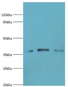 CAPG Antibody - Western blot. All lanes: Macrophage-capping protein antibody at 1 ug/ml. Lane 1: HeLa whole cell lysate. Lane 2: NIH3T3 whole cell lysate. Lane 3: rat lung tissue. secondary Goat polyclonal to rabbit at 1:10000 dilution. Predicted band size: 38 kDa. Observed band size: 38 kDa.